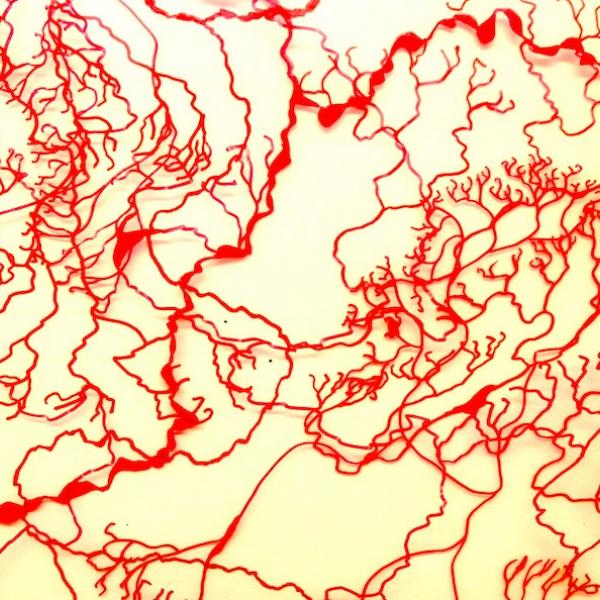 A complicated array of squiggling red lines on a yellow background