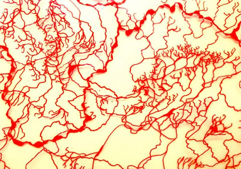 A complicated array of squiggling red lines on a yellow background